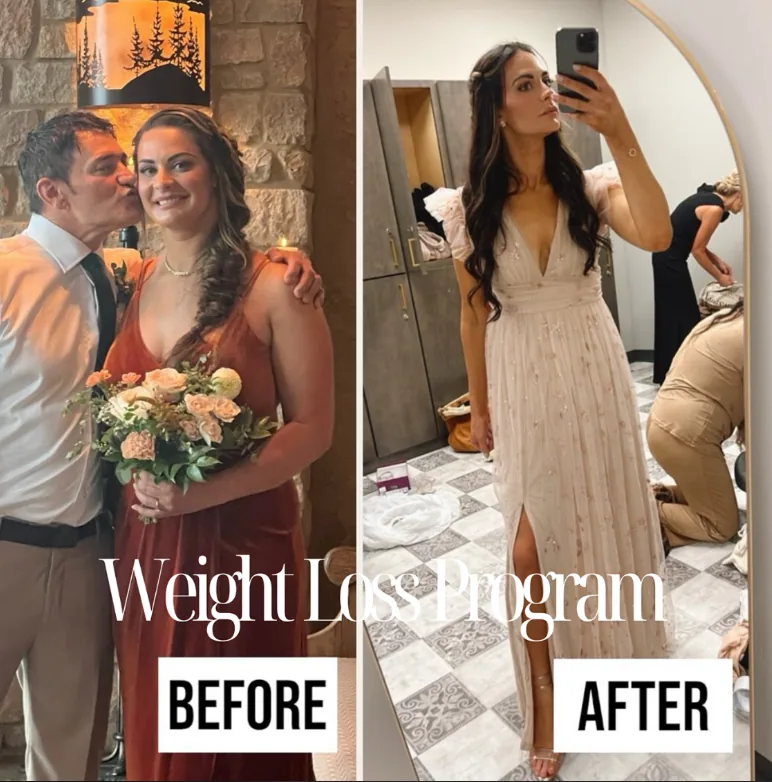 Medical weight loss before and after — GLOW Aesthetic Clinic